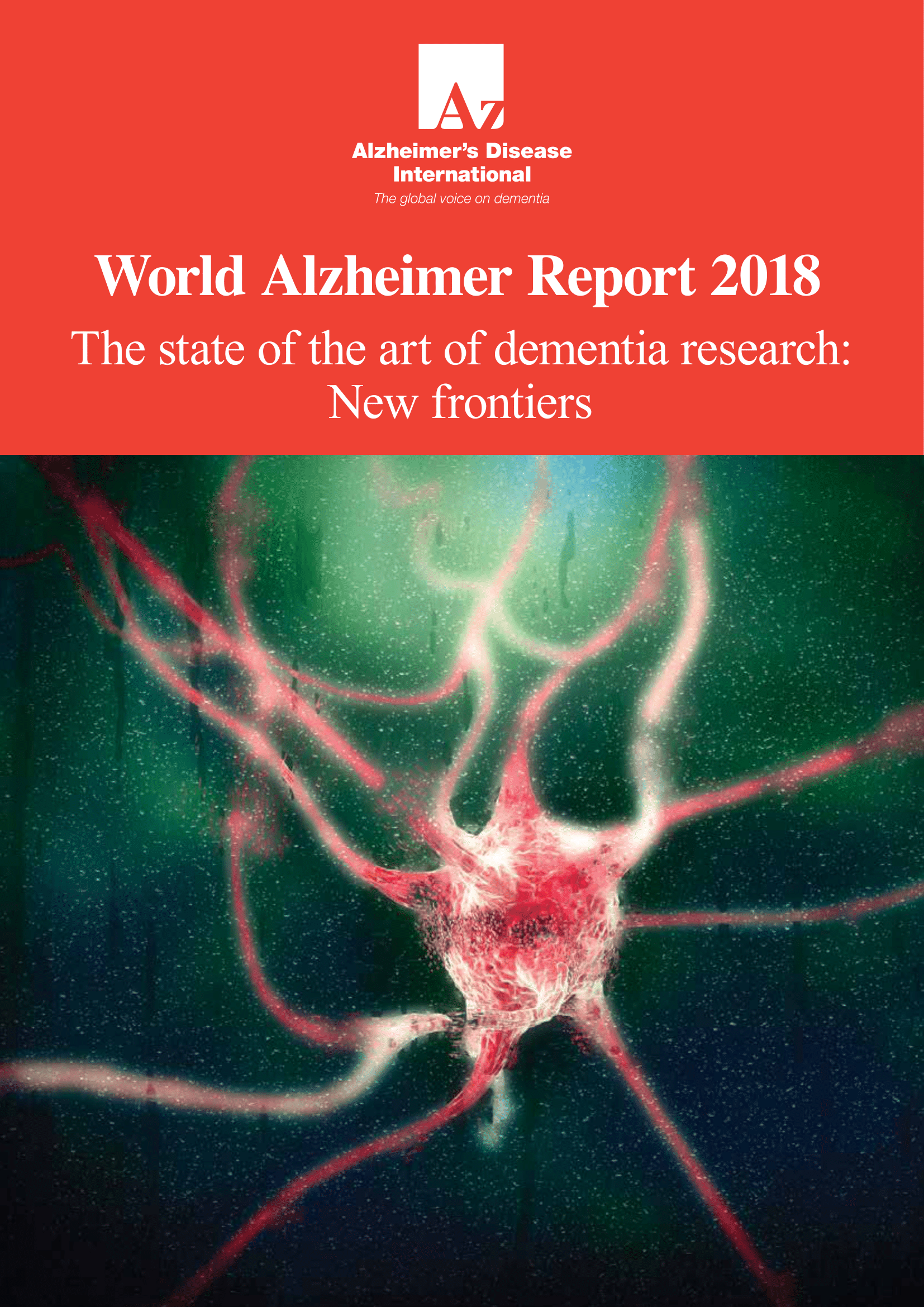 alzheimer's research news